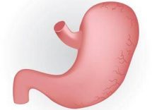caldo peggiora sintomi del reflusso in casi gravi chirurgia opzione risolutiva 2