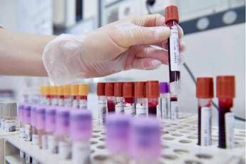 sibioc su ipotesi regione lazio no esternalizzazione medicina di laboratorio 2