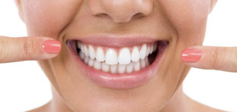 sorrisodenti