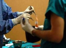 trapianti a modena il primo in europa di fegato da donatore vivente con robot 2