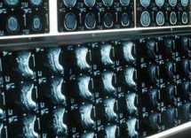 ipofosfatemia legata allx primo bilancio e prospettive su linee guida 2