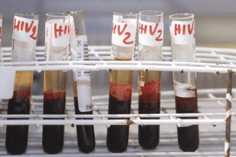 hiv oggi a bari incontro su terapie long acting e prevenzione 2