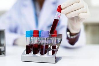 aviaria cose il virus h9n2 come si trasmette e i rischi per luomo 2