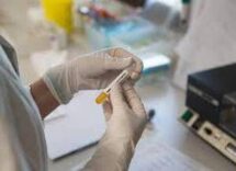 cancro prostata metastatico ormonosensibile nuovi dati su darolutamide mostrano benefici in sopravvivenza 2