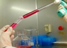 ematologia gimema oltre 17mila pazienti coinvolti in studi clinici nazionali 2