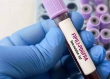 giornata patologie eosinofile allergologo caminati diagnosi complessa 2