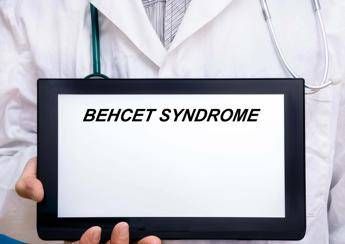 giornata sindrome behcet esperto oggi possiamo prevenire cecita 2