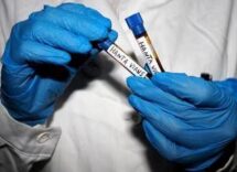 hantavirus ema monitora diffusione pronti a supportare iter vaccini 2