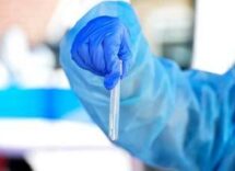 hantavirus il punto contagio e sintomi cosa ce da sapere e come proteggersi 2