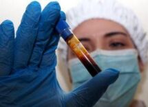 hantavirus negativo il turista inglese in quarantena a milano test per una donna ricoverata a messina 2