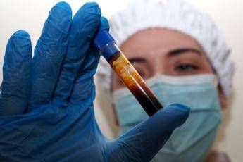 hantavirus negativo il turista inglese in quarantena a milano test per una donna ricoverata a messina 2