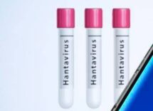 hantavirus non puo causare pandemia ma epidemie gravi si lo studio su focolaio mv hondius 2