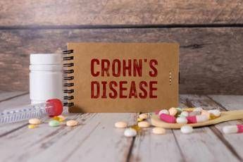 malattia crohn con fistole nuovi dati su terapia monoclonale 2