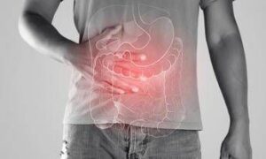 malattie infiammatorie croniche lindagine 4 pazienti su 5 non ricevono consulenze nutrizionali 2