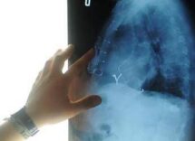 radiologia interventistica ssn e fondazioni per cure piu accessibili 2