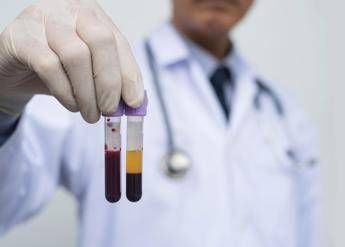 ricerca allo studio analisi sangue a casa e test cerebrali online per scoprire rischio demenza 2
