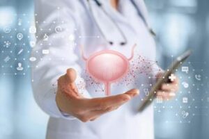 cancro alla vescica approvato rimborso per immunoterapia prima e dopo chirurgia 2