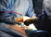 operata al femore a 104 anni gia in piedi il giorno successivo allintervento 2