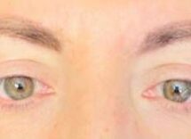 visione annebbiata o distorta spia di retinopatia ne soffre il 30 dei diabetici prevenzione larma piu efficace 2