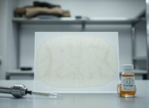 Come cervello, ormoni e prevenzione influenzano la fragilità ossea