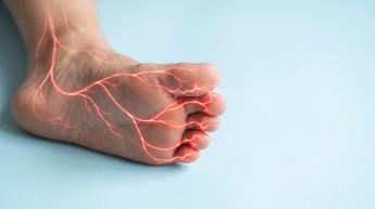 asl roma 4 presentato nuovo pdta per neuropatia diabetica dolorosa 2