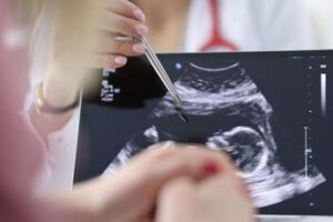 chirurgia si rompe laorta e viene operata con il bimbo in utero intervento record a milano 2