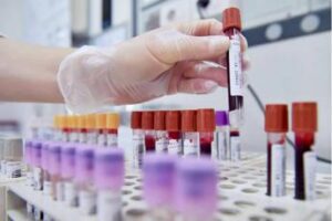 hiv dalla sicilia il modello per estendere terapie long acting 2