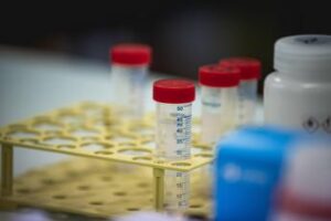 difterite quali rischi dalla trasmissione alla vaccinazione ecco cosa sapere 2