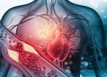 arterosclerosi studio nuova molecola riduce di piu il colesterolo cattivo 2