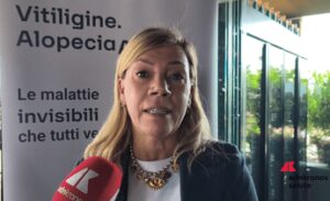 cordella abbvie vitiligine e alopecia siano riconosciute da ssn 2