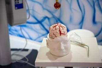 dai gliomi al parkinson cosi lintelligenza artificiale aiuta la neurochirurgia 2