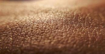 dermatite atopica quando la pelle condiziona la vita diari atipici da voce ai pazienti 2
