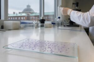 Studio danese rivela l'impatto di abitudini e condizioni fisiche sulla qualità del liquido seminale