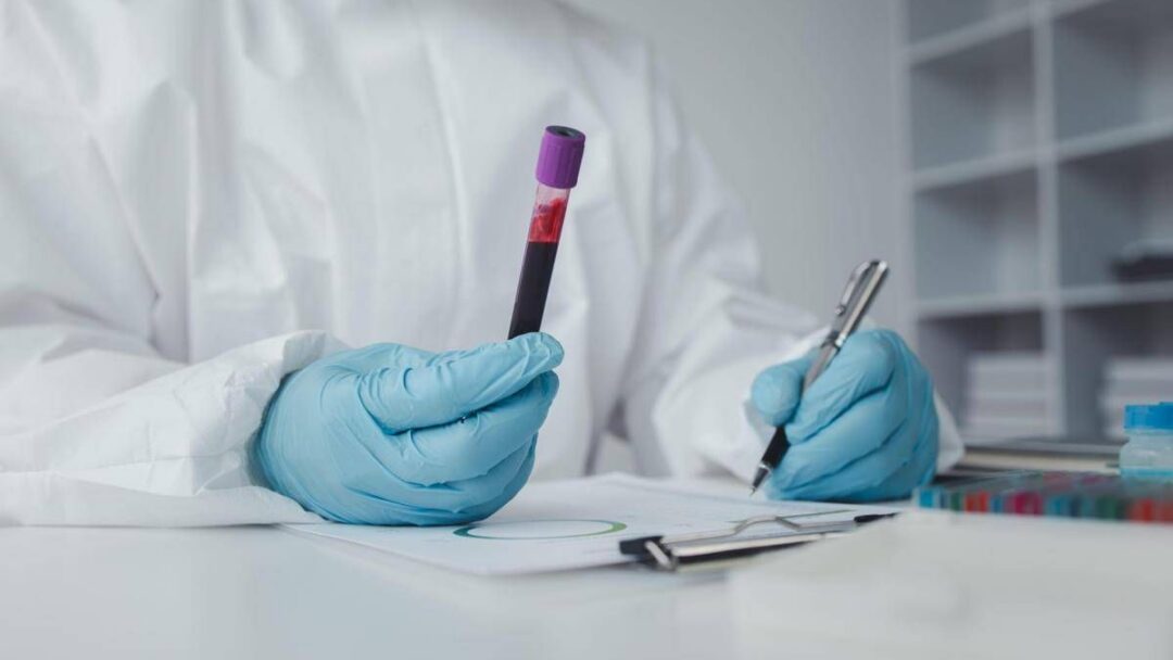in francia primo caso umano di virus shamonda il paziente e morto alert ecdc 2