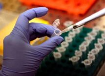 morbillo pennsylvania segnala sesto morto 39enne con patologie e gia infettata di recente 2