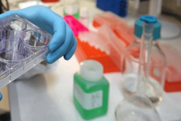 Tumori, in Europa mortalità maschile in calo del 7,8%: in Italia 15 mesi per le nuove terapie
