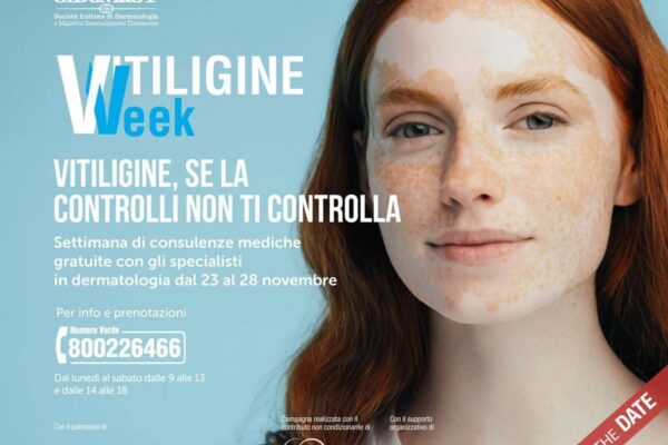 Vitiligine week, Sidemast: “Circa mille consulenze dermatologiche gratuite”